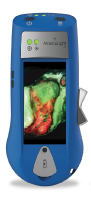 MolecuLight i:X device, front