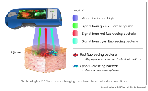 bacteria light detector