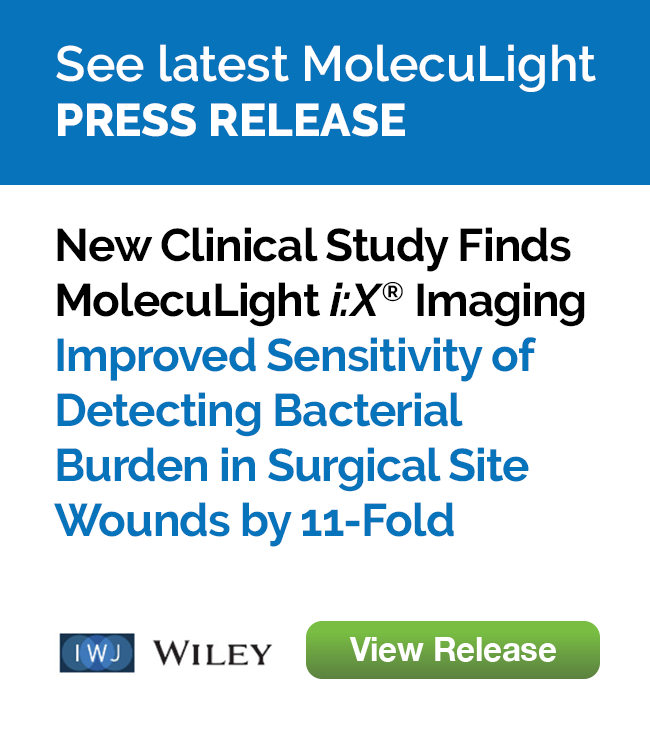 New Clinical Study Finds MolecuLight <i><strong>i:</strong>X<sup>®</sup></i> Point-of-Care Imaging Improved Sensitivity of Detecting Bacterial Burden in Surgical Site Wounds by 11-Fold